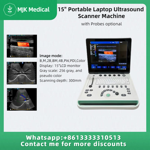 Macchina scanner ultrasuoni - scanner,