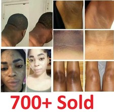 Crema Sbiancante Pelle Scura