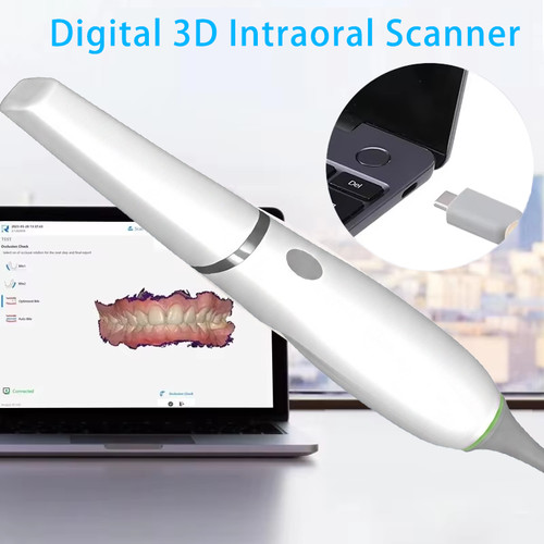Scanner intraorale dentale