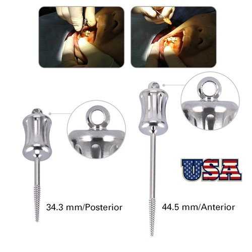 Trapano radice rotta - radice, dentale