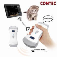Scanner ultrasuoni wireless