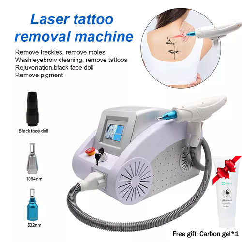 Macchina rimozione tatuaggi