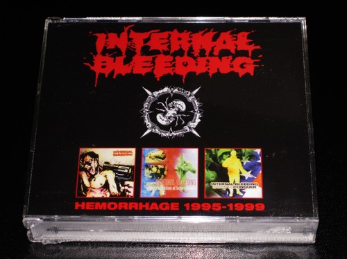 Internal bleeding hemorrhage - internal,