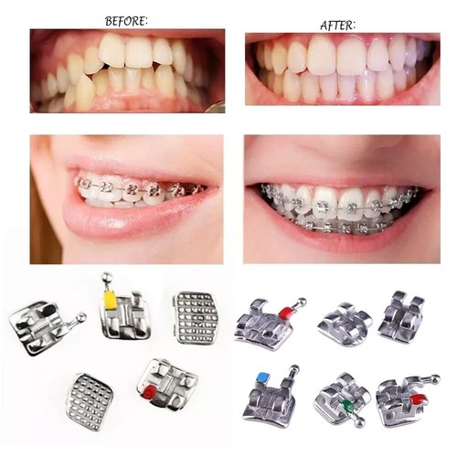 Confezione 100 staffe - 1-100,