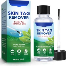 Verruche Rimozione, Fibromi Penduli Rimozione, Prodotti per la Cura Della Pelle