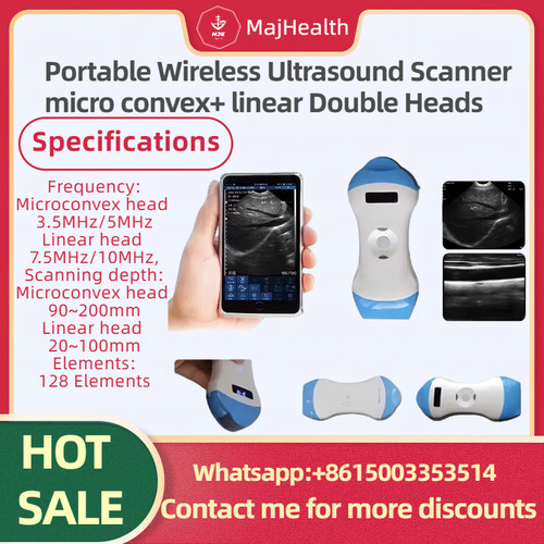 Scanner ultrasuoni wireless - scanner,