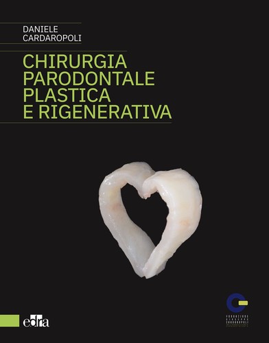 Chirurgia parodontale plastica