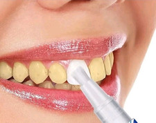 Penna Sbiancante Denti Bianchi Puliti Gel Attivo Rimozione Macchie Caffè Tè 