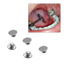 50 Pezzi Bottoni Linguali