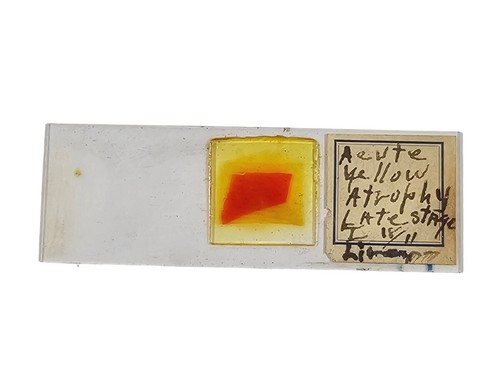 Antico scivolo medico