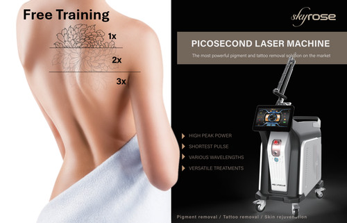 Laser picosecondi - laser,