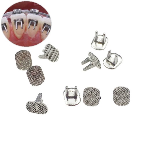 Cerniera bondable monoblocco - bondable,