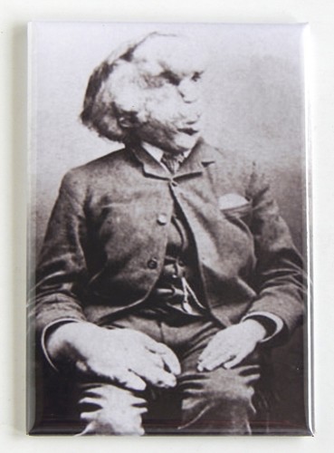 Joseph merrick uomo - merrick, "l'uomo