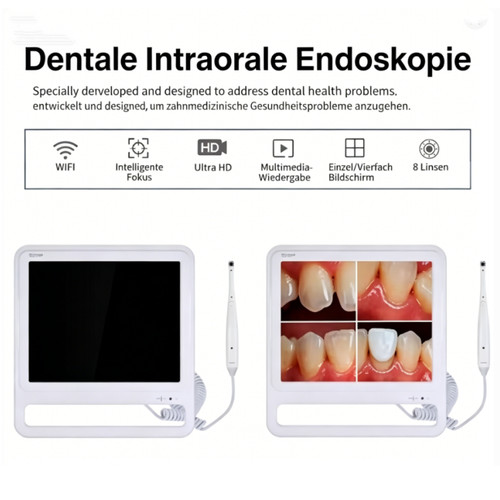 Telecamera intraorale dentale