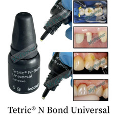 Ivoclar Tetric N-Bond agente
