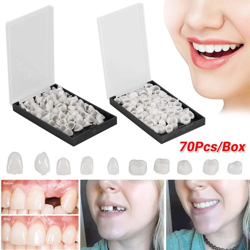 Denti temporanei corone - denti,