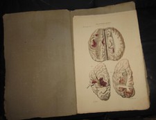 1839 fasc cruveilhier - 1839, fasc.