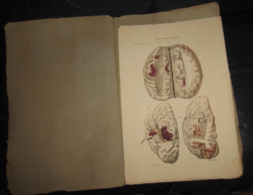 1839 fasc cruveilhier - 1839, fasc.