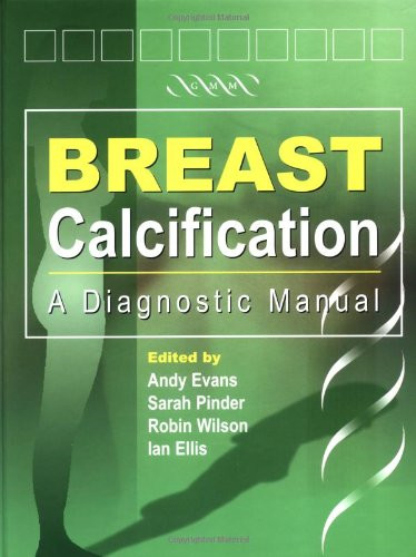 Breast calcification a - breast,