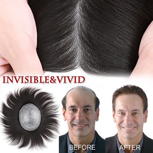 Parrucche ricambio capelli