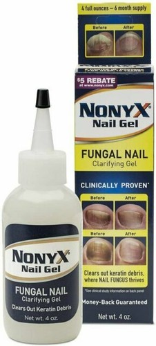 Nonyx trattamento gel - nonyx,