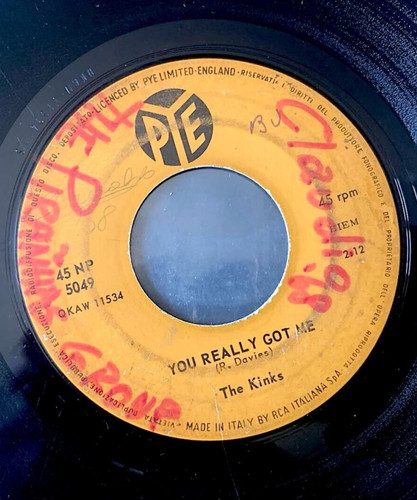 The kinks you really - the, –