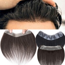 Parrucche uomo topper toupee