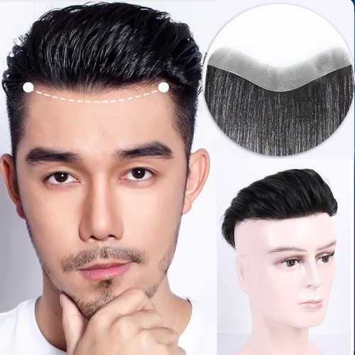 Topper fronte capelli - , umani