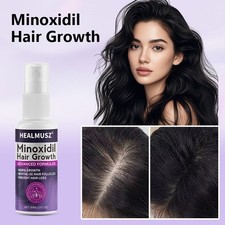 Minoxidil 2% per Donna Spray