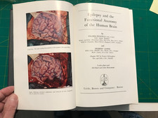Epilepsy & Functional Anatomy of the Human Brain