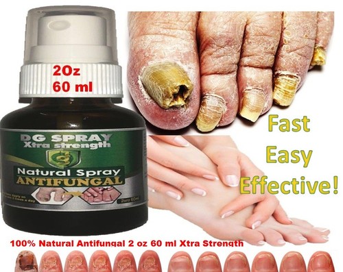 Supporto antifungo fungo - supporto,