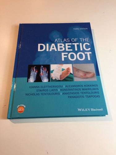 Atlas the diabetic - atlas,