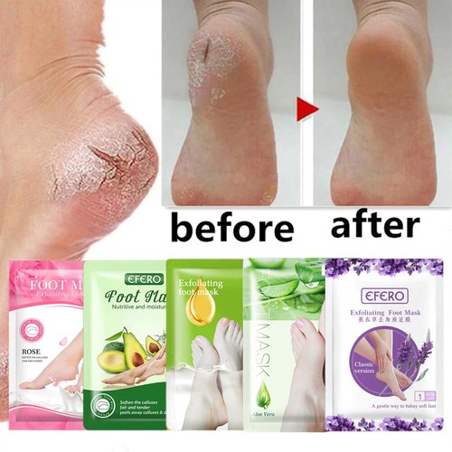 Maschera piedi esfoliante peel - maschera,