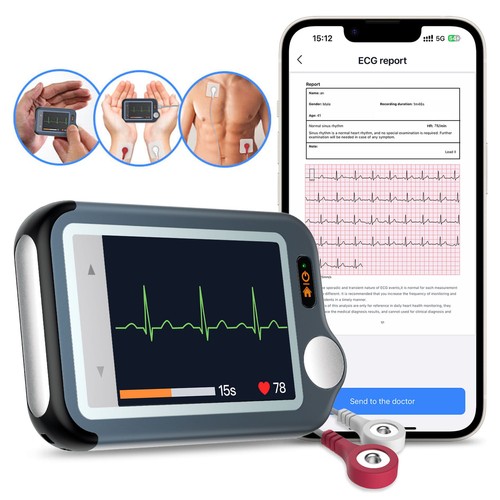 Checkme monitor ecg portatile - monitor,