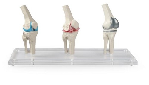 Modello anatomico impianto - modello,