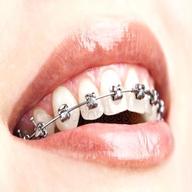 ortodonzia usato