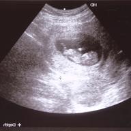 ultrasound usato